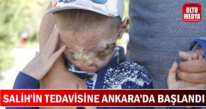 Cilt kanseri 8 yaşındaki Salih'in tedavisi Ankara'da başladı