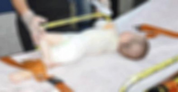 Üzerine Kaynar Su Dökülen Çocuk Yandı