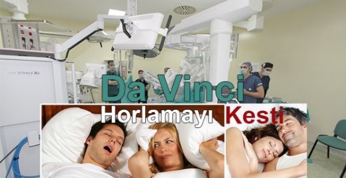 Da Vinci Ameliyat Robotu Horlamayı Kesti