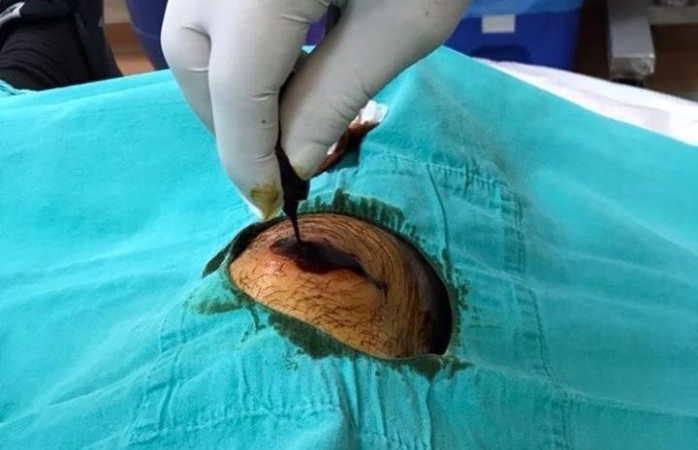 Oltu Kaldırımlarında Ayağı Bu Hale Geldi!