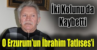 Erzurumlu Sanatçı Protez için Destek İstedi!