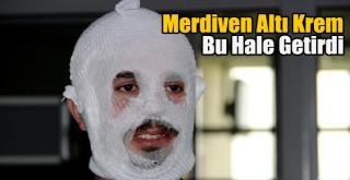 Merdiven Altı Krem Bu Hale Getirdi!