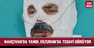 Nahçıvan'da Yandı, Erzurum'da Tedavi Görüyor